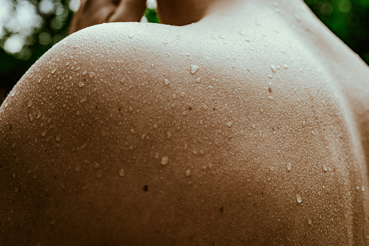 Privatpraxis Ästhetische Medizin: Botulinumtoxin Hyperhidrose